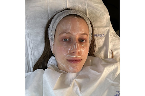 Jamie receiving vitamin C/enzyme peel