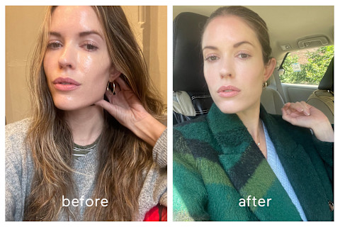 mbg beauty director before and after sofwave mbg beauty director before and after sofwave