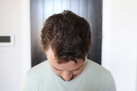 Blake hair top view