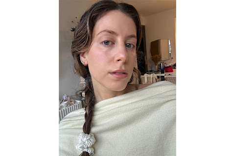 Jamie after using melatonin serum Jamie after using melatonin serum