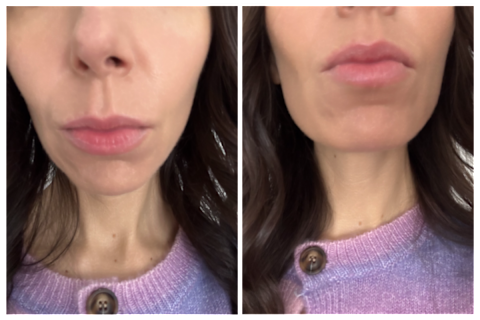 patchology lip renewal gels