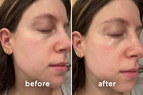 jamie schneider before & after skincueticals jamie schneider before & after skincueticals