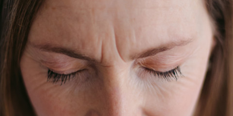 woman with forehead wrinkles and frown lines woman with forehead wrinkles and frown lines