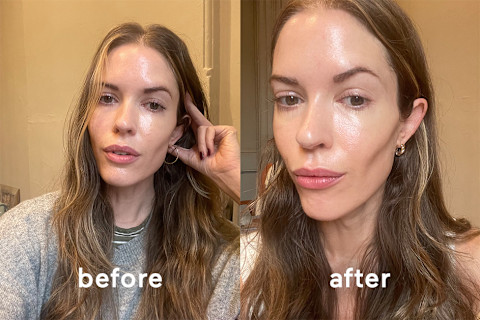 mindbodygreen beauty director Alexandra Engler before and after using the LYMA laser mindbodygreen beauty director Alexandra Engler before and after using the LYMA laser