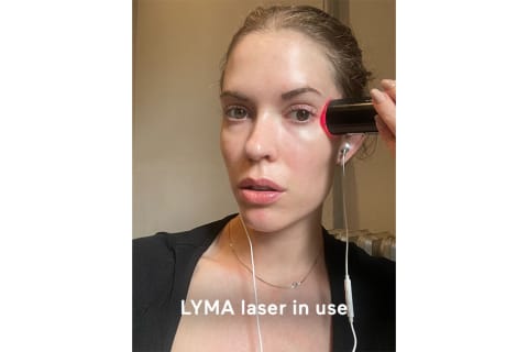 mindbodygreen beauty director Alexandra Engler using the LYMA laser