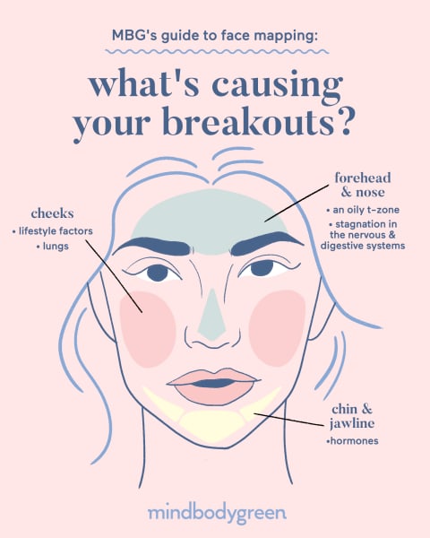 acne diagram of the face