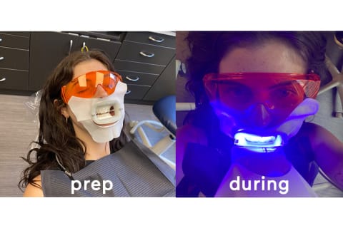 woman getting teeth whitening 