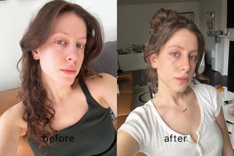 Jamie's before/after results with NuFACE