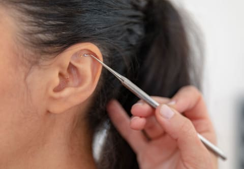Ear Allure Weight Loss Earrings Reviews
