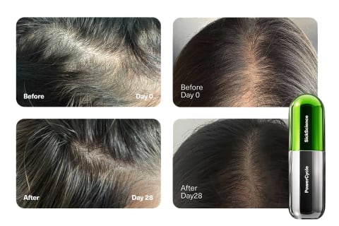 before and after images of scalp after 28 days of using the serum