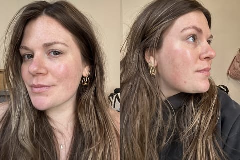 side by side of profile of woman after using the bon charge red light mask