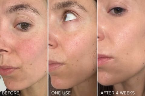 before and after images of writer after using the restore cream for one night and four weeks