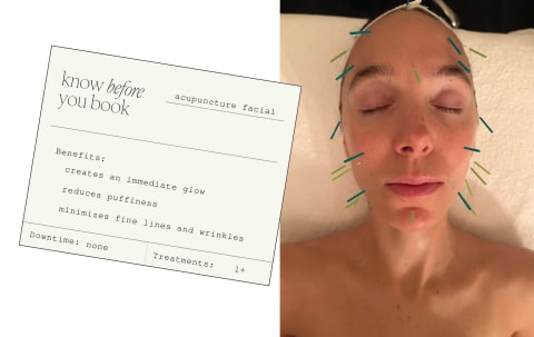 Know before you book: Acupuncture facial benefits + basic info