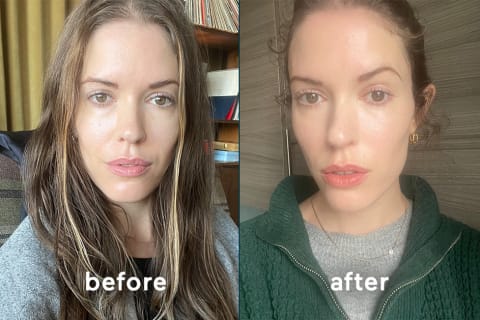 Know before you book: the green peel before and after