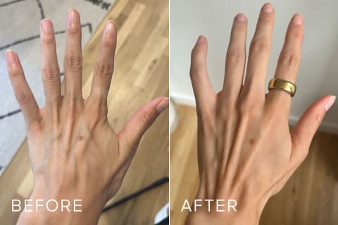 before and after of writer's hand