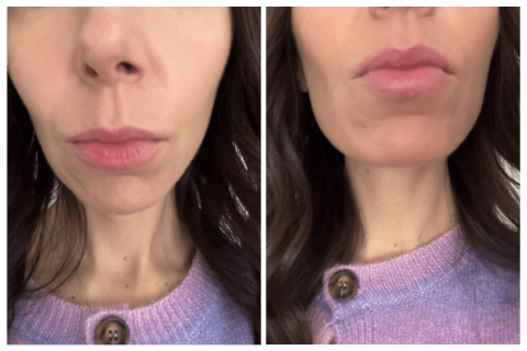 patchology lip renewal gels