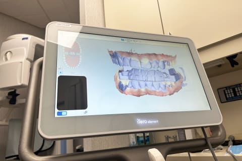 Proclaim 3D oral scan at dentist office (Dr. Glassman)