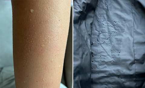 image of sweat on writer's arm after using the blanket next to a picture of the blanket