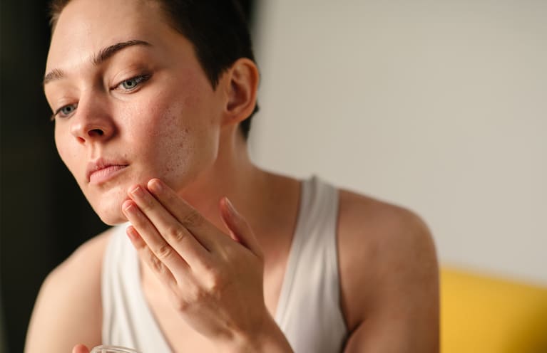 These Are The Best (& We Mean Best!) Acne Treatments For Every Kind Of Spot