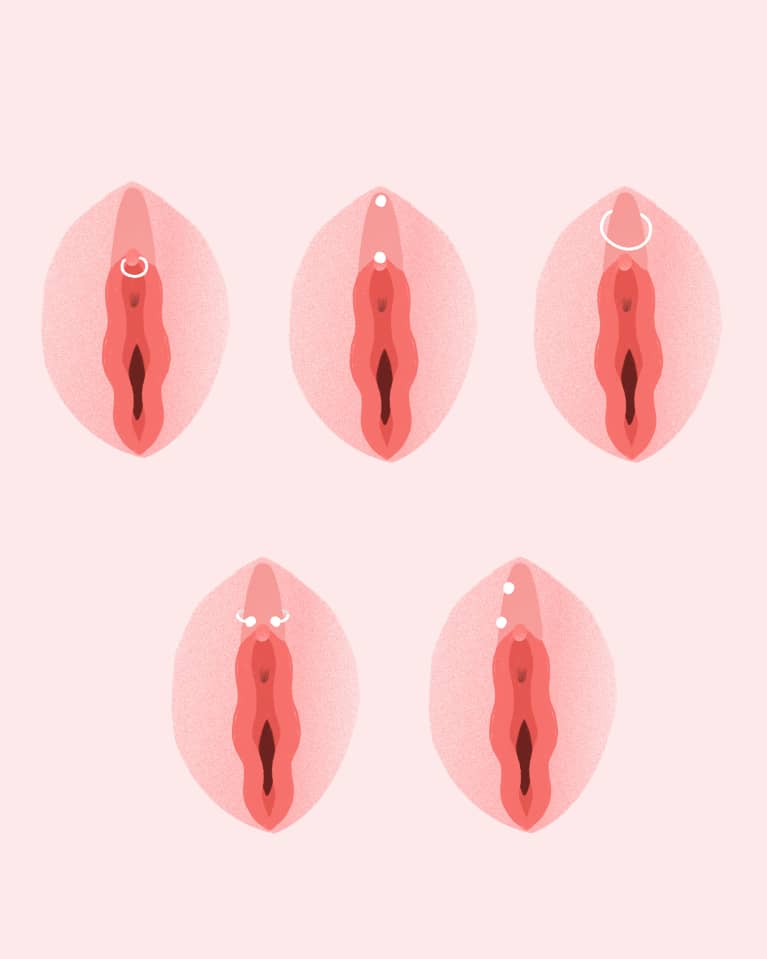 Top row from left to right: clitoral glans piercing, VCH piercing, HCH piercing. Bottom row from left to right: triangle piercing, Princess Diane piercing. Illustration of various types of clit piercings.