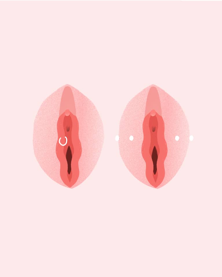 Image showing two types of labia piercings.