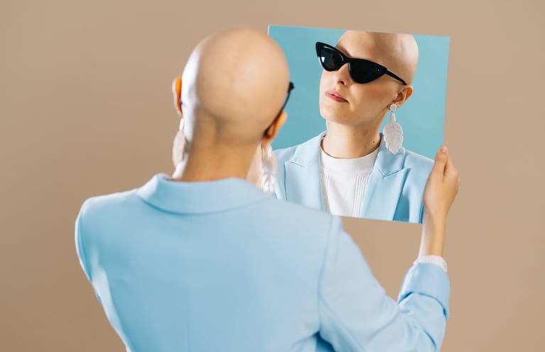 I've Lost All Of My Hair & May Never Get It Back: Here's What It's Like I've Lost All Of My Hair & May Never Get It Back: Here's What It's Like