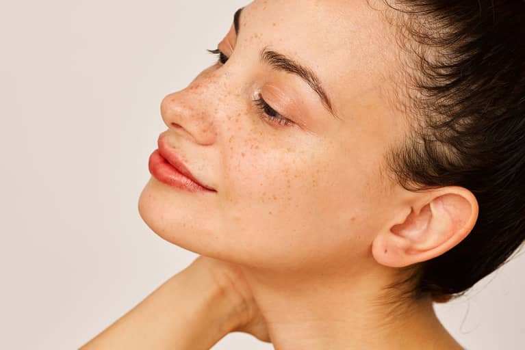 How To Cycle Your Skin Care Products If You Have Rosacea, From a Dermatologist